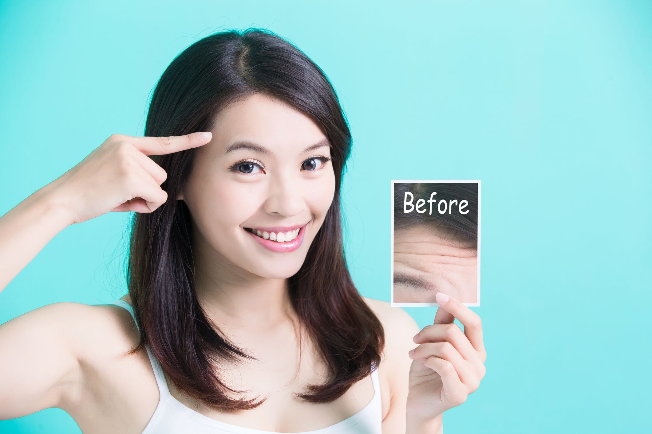 Before and After Forehead Procedure Correcting Wrinkles